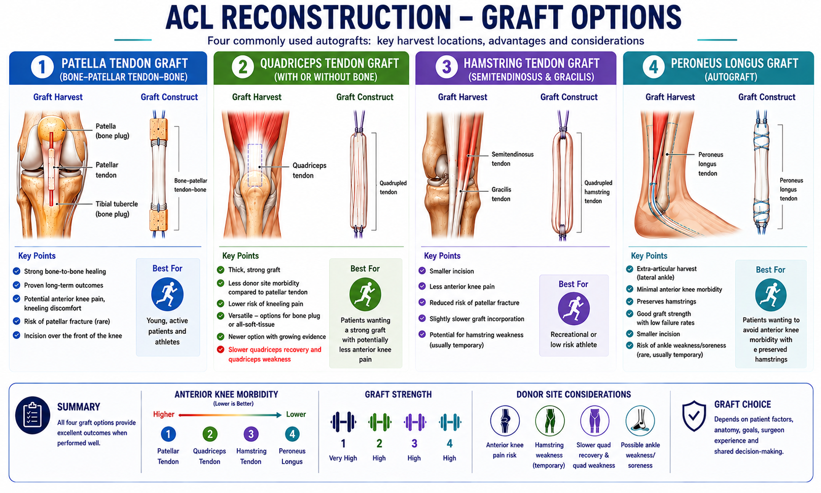 ACL graft options